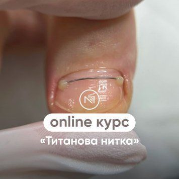 Онлайн курс "Титановая нить" МС-029 фото