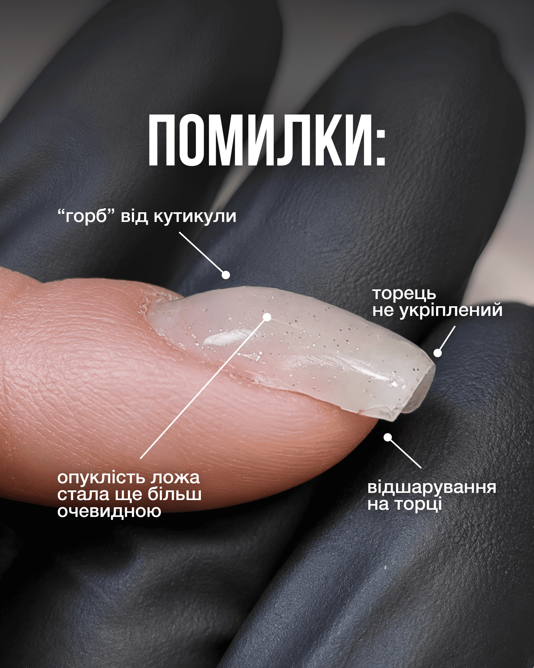 Помилки зміцнення клюючого нігтя: горб біля кутикули, неукріплений торець і відшарування